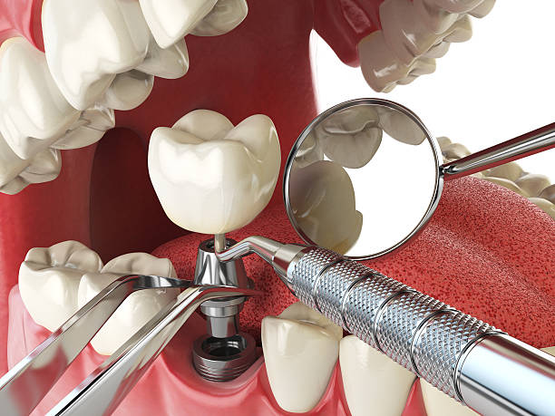 Best Emergency Dental Extractions in Richland, GA