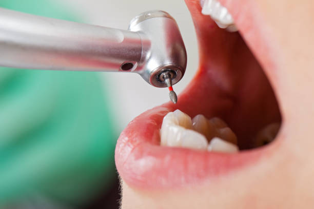 Best Mobile Emergency Dentist in Richland, GA